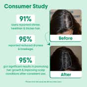 Aravi Organic Rosemary Water Spray For Promotes Healthy Boosts Growth and Thicker Hair (100 ml)
