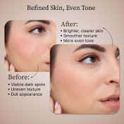 Dr.Reju-All Advanced LC-Ceramide Barrier Cream, Soothing Repair for Sensitive Skin (50 ml)