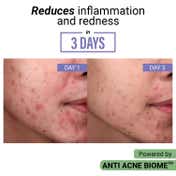 Sereko Anti Acne Foaming Face Wash with 1% Salicylic Acid and 2% Glycolic Acid (100 ml)