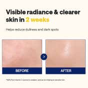 MEDIHEAL Vitamin C Brightening Serum (40 ml)