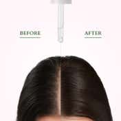 Lotus Organics+ Hair Growth Active Concentrate Serum (28 ml)