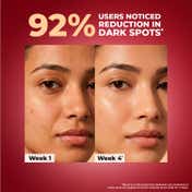 Chicnutrix Outshine Skin Glow Face Serum With Vitamin C Glutathione Arbutin & Niacinamide (30 ml)