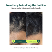 RESOLVE Scalp Snack Hair Growth & Scalp Renewal Serum (50 ml)