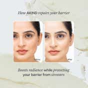Akind Bright Idea Radiance Serum Mini (16.8ml), Brightening & Fading Pigmentation with 10% Vit C
