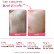 The Pink Foundry Barrier Repair and Restore Moisturiser (50 ml)