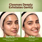 Mamaearth Mung Bean Pore Cleansing Foam Scrub with Mung Bean (100 g)