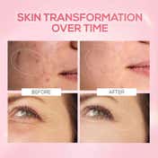 Renee Cosmetics Pink Therapy PDRN Pink Peptide Face Serum (30 ml)