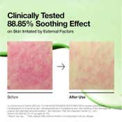 Anua Azelaic 10 Hyaluron Redness Soothing Pad (230 ml)