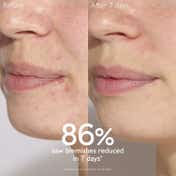 Caudalie Vinopure Blemish Control Salicylic Serum (30ml)
