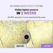 MEDIHEAL PDRN Lifting Pad (170 ml)