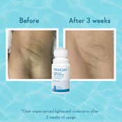 WishCare Aqua Fresh Underarm Roll On Serum Reduces Pigmentation and Prevents Body Odour (50 ml)