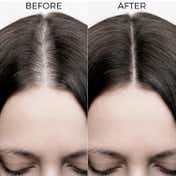 Brillare 10% Rosemary Hair Oil for Hair Growth Reduces Hair Fall and Strengthens Hair (100 ml)