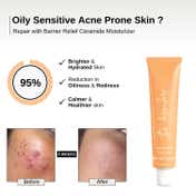 The Formularx Barrier Relief Ceramide Lightweight Moisturizer for Oily and Acne prone Skin (50 g)