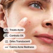 The Ordinary Sulfur 10% Powder-to-Cream Concentrate - Acne Spot Correction for Sensitive Skin (5 g)