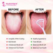 Majestique Flexible Easy-to-Use Plastic Tongue Cleaner for Adults & Children (3 pcs)
