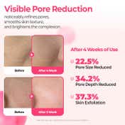 Dr.Melaxin Cemenrete Cyano Pink Spicule Serum Microneedling Serum for Wrinkle & Pore Care (30 ml)
