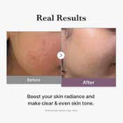 medicube Age-R Glutathione Glow Toner (140 ml)