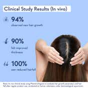 WishCare Hair Growth Serum Concentrate with Redensyl In Vivo Tested Boosts Hair Growth (20 ml)