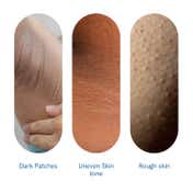 Be Bodywise Pigmentation Repair Cream (100 g)