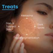 FCL AHA Lightening Gel Glycolic Acid Treats Hyperpigmentation Dark spots Reduce Dark Spots (15 ml)