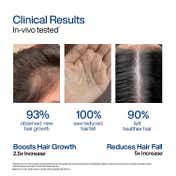 WishCare Hair Growth Serum Concentrate with Redensyl In Vivo Tested Boosts Hair Growth (30 ml)