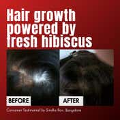 Hibiscus Monkey HM Love Scalp & Hair Growth Oil with Fresh Hibiscus & Coconut Milk Oil (50 ml)