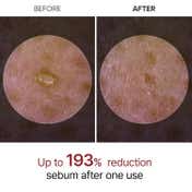 Dr.Melaxin Peel Shot Exfoliating White Rice Ampoule Reduces Whiteheads & Pores in 1 Use (80 ml)