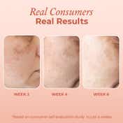 The Pink Foundry Dark Spot & Hyperpigmentation Correcting Power Serum (30ml)