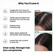The Skin Story Anti Dandruff Shampoo (250 ml)