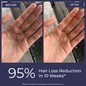 Conscious Chemist Full Strength Hair Growth Oil (100 ml)