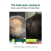 RESOLVE Scalp Snack Hair Growth & Scalp Renewal Serum (50 ml)