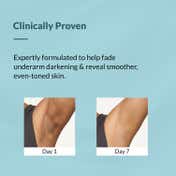 Fixderma Nigrifix Underarm Mist Spray for Dark Underarms Pigmentation Removal (100 ml)