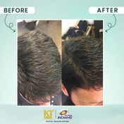 KT MEN Dark Revive Anti Grey Conditioning Shampoo Restore Natural Black - MI (200 ml)