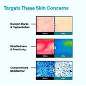 MEDIHEAL Madecassoside Essential Mask for Blemish Repair (24 ml)
