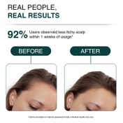 SH-RD Reishi Volumizing Shampoo for Fine and Thinning Hair Keratin (200 ml)