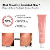The Formularx Barrier Plus Peptide Ceramide Moisturizer for Dry Normal and Sensitive Skin (50 g)
