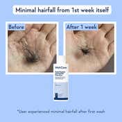 WishCare Multi Peptide Anti Hairfall Shampoo with Rosemary Boosts Hair Growth (120 ml)