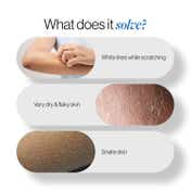Be Bodywise 20% Urea Body Lotion - Advanced Formulation (300 ml)