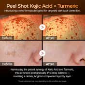 Dr.Melaxin Peel Shot Exfoliating Kojic Acid Turmeric Serum (80 ml)