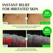 EQQUALBERRY Aloe Pdrn Calming Toner (150 ml)