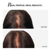 Novology Follicle Revive Scalp Serum,For Hair Growth,Suitable For Sensitive Scalp,Dermat Tested (50ml)