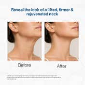 FCL Retinol Neck Firming Complex for Fine Lines and Wrinkle Retinol Night Cream (50 g)