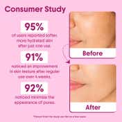 Aravi Organic 100% Pure & Natural Rose Water Steam Distilled Face Spray Toner (150 ml)