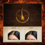 Indulekha Bringha Hair Oil with 11 Herbs Ayurvedic Hair Oil for Hair Growth (50 ml)