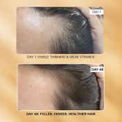 Ras Luxury Skincare Root Ine Hair Growth Serum with 19.5% Scalp Actives (50 ml)