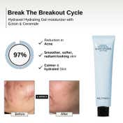 The Formularx Hydraveil Hydrating Gel Moisturizer with Ectoin & Ceramide for Acne Prone Skin (50 g)
