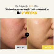 MEDIHEAL Vitamin C Bright Toning Pad (180 ml)