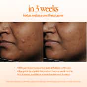 d'you Embrace Pro-Aging Retinoid Treatment (30 ml)