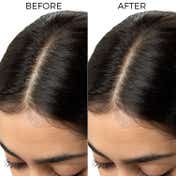 Brillare Lactylate Anti Dandruff Shampoo Soothes Itchy Scalp and Reduces Dandruff (200 ml)