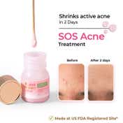 The Pink Foundry Overnight Acne Spot Corrector (15ml)
